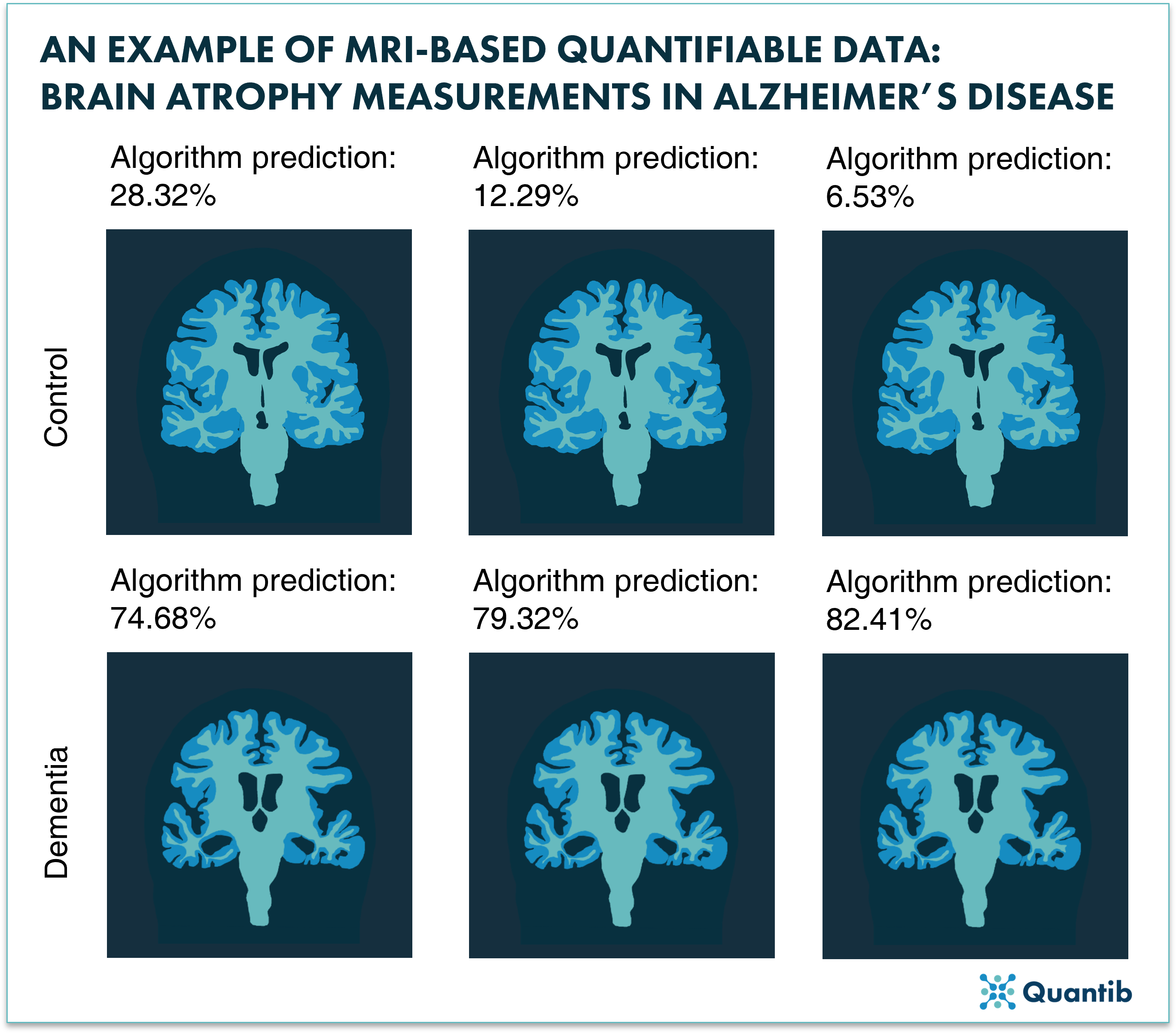 Visualizing Dementia: How Developments In CT And MR Imaging Help ...